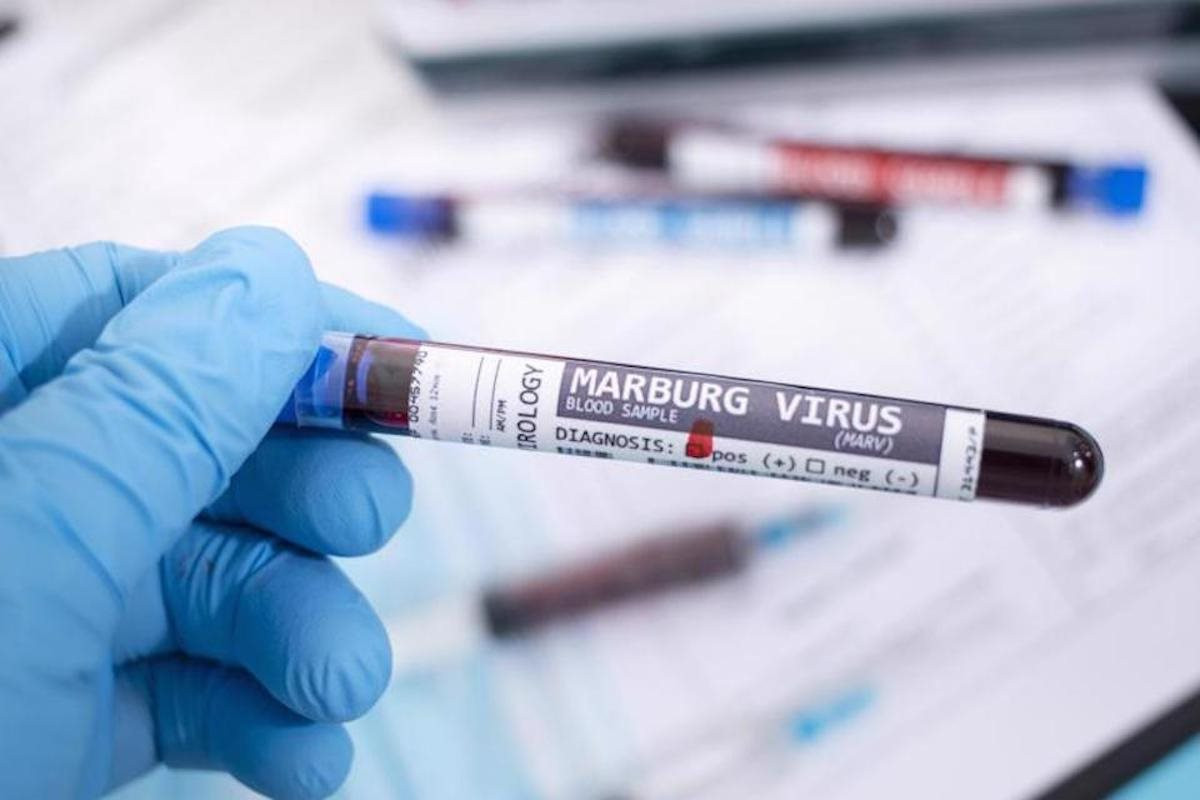 Thái Nguyên: Chủ động giám sát dịch bệnh do vi-rút Marburg