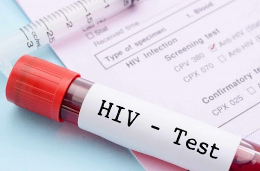 Phát triển công nghệ mới xét nghiệm HIV tại chỗ chính xác trong vài phút