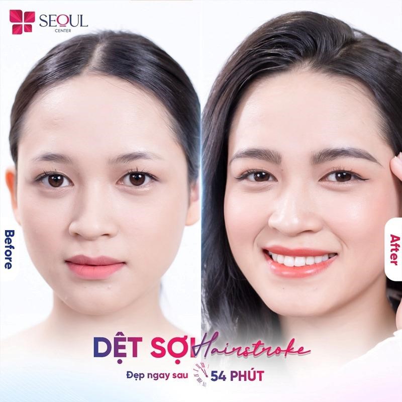 
Hình ảnh khách hàng trước và sau khi thực hiện dịch vụ dệt sợi Hairstroke chân mày công nghệ cao tại Seoul Center