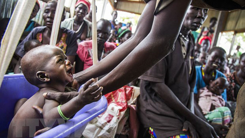 Trẻ em suy dinh dưỡng được điều trị tại Panthau, Nam Sudan. (Ảnh: AFP/TTXVN)