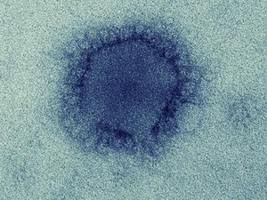 Virus gây bệnh MERS từng lây từ động vật sang người
